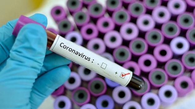 Όσα πρέπει να ξέρετε για τον Covid 19